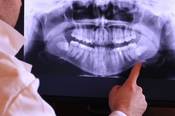 Best Emergency Tooth Extraction in Jeffersontown, KY