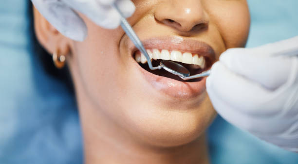 Best Emergency Gum Treatment in Jeffersontown, KY